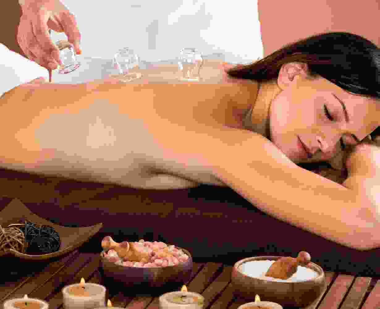 Cupping Therapy Cupping Therapy